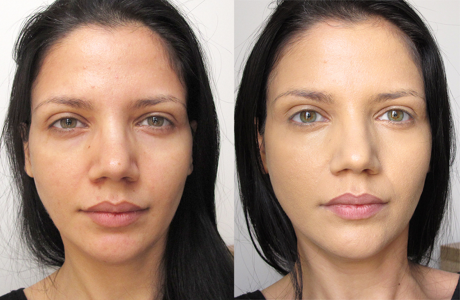 dermacol_before_after